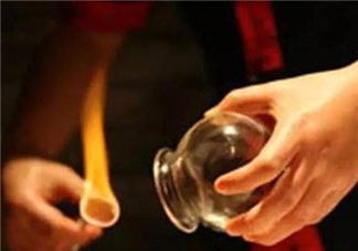 關(guān)節(jié)炎可以拔火罐嗎？關(guān)節(jié)炎拔罐管用嗎？