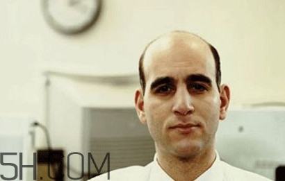 禿頂了還能長(zhǎng)出頭發(fā)嗎？禿頂和性欲太強(qiáng)是不是有關(guān)