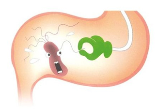 幽門螺桿菌會(huì)傳染嗎？幽門螺桿菌吃什么藥