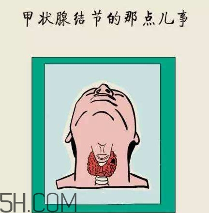 為什么會得甲狀腺結節(jié)？甲狀腺節(jié)結是什么？