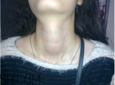 甲狀腺結節(jié)掛什么科？甲狀腺結節(jié)可以懷孕嗎