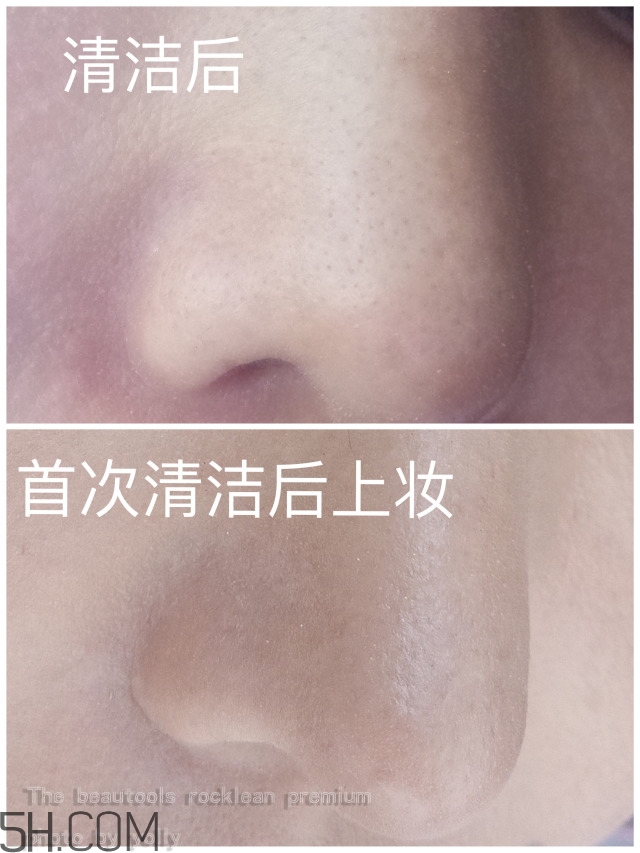 the beautools毛孔清潔器好用嗎_24k黑頭鏟評測