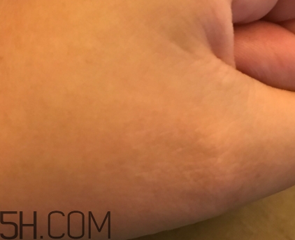 芳丹薄羅眼膜怎么用？芳丹薄羅眼膜要洗嗎