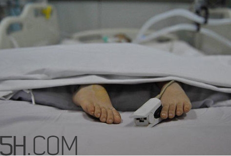 腦死亡是什么意思？腦死亡判定有嚴(yán)格標(biāo)準(zhǔn)