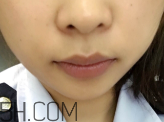 小蜜蜂細(xì)致修護(hù)唇膏很油嗎？夏天用合適嗎？