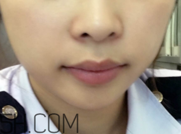 小蜜蜂細(xì)致修護(hù)唇膏很油嗎？夏天用合適嗎？