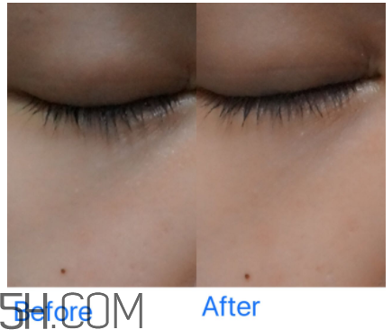 小蜜蜂水洗面膜怎么樣？小蜜蜂水洗面膜好用嗎？