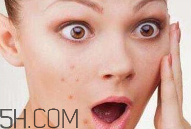 卸妝油適合痘痘肌膚嗎？植村秀卸妝油哪款最好用？