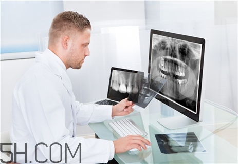 骨折要打石膏嗎？骨折要花費多少錢？