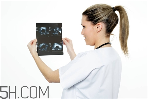 骨折會(huì)影響月經(jīng)嗎？骨折對性功能有影響嗎？