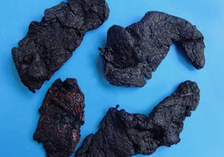 熟地黃是什么？熟地黃有什么功效？