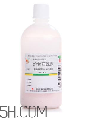 爐甘石洗劑是激素藥嗎？爐甘石洗劑是處方藥嗎？