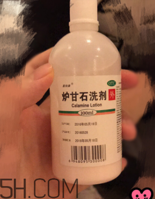 爐甘石洗劑是洗還是擦？爐甘石洗劑是什么顏色？