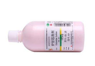 爐甘石洗劑能治痘痘嗎？爐甘石洗劑能治皰疹嗎？