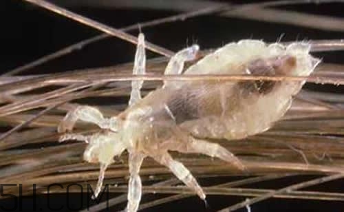 孩子長虱子是怎么回事？孩子長虱子該怎么辦？