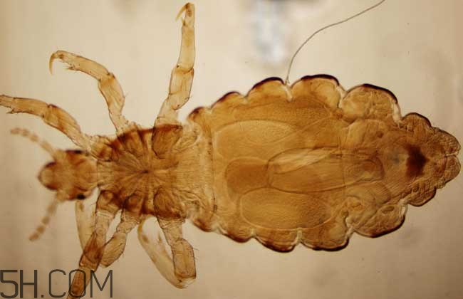 孩子長虱子是怎么回事？孩子長虱子該怎么辦？