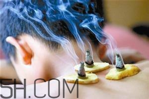 艾灸對(duì)慢性咽炎有用嗎？慢性咽炎可以通過(guò)艾灸來(lái)治療嗎？