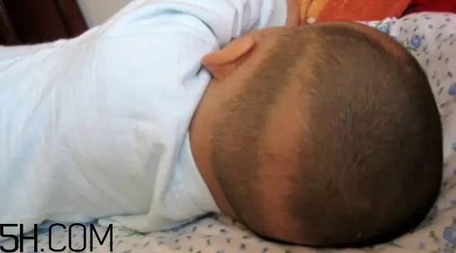 寶寶枕禿怎么辦？如何改善寶寶枕禿現(xiàn)象？