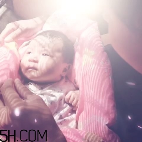 寶寶枕禿怎么辦？如何改善寶寶枕禿現(xiàn)象？