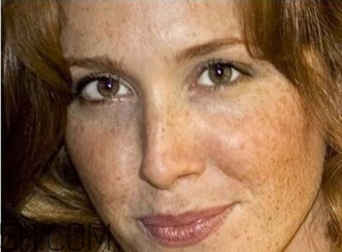 血瘀體質(zhì)容易長色斑嗎？有血瘀體質(zhì)的人如何去除色斑呢？