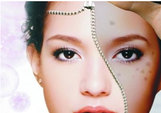 血瘀體質(zhì)容易長色斑嗎？有血瘀體質(zhì)的人如何去除色斑呢？