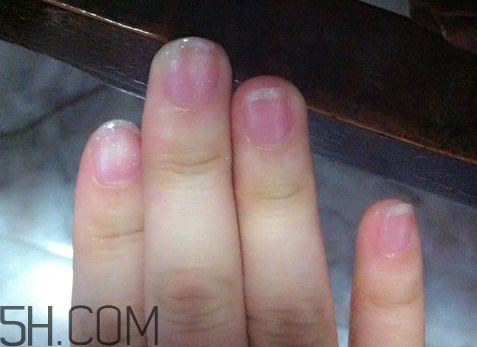 美甲后指甲受損怎么辦？指甲破損怎么修復(fù)？