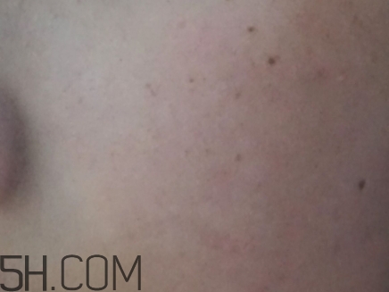 724高保濕面霜是什么？724高保濕面霜好用嗎？