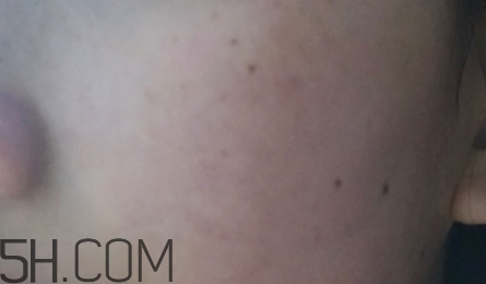 724高保濕面霜是什么？724高保濕面霜好用嗎？