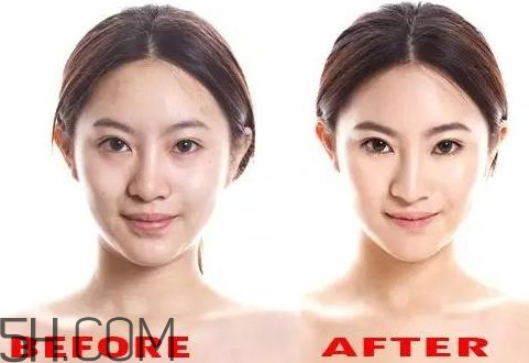 貝洛娜水光針騙局 貝洛娜水光針真假辨別 貝洛娜水光針騙局 貝洛娜水光針真假辨別