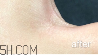 雅頓小銀蛋是什么？雅頓小銀蛋多少錢？