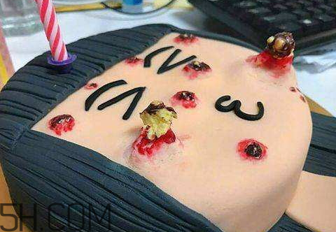 擠痘痘蛋糕是什么 擠痘痘蛋糕做法 擠痘痘蛋糕是什么 擠痘痘蛋糕做法