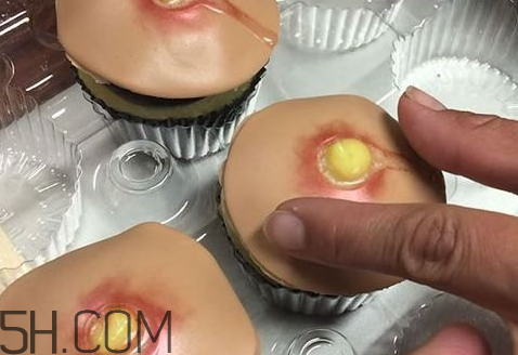 擠痘痘蛋糕是什么 擠痘痘蛋糕做法 擠痘痘蛋糕是什么 擠痘痘蛋糕做法