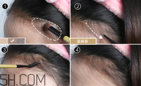 發(fā)際線不好看怎么修飾 完美解決6種發(fā)際線問(wèn)題 發(fā)際線不好看怎么修飾 完美解決6種發(fā)際線問(wèn)題