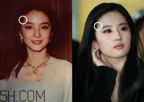 發(fā)際線不好看怎么修飾 完美解決6種發(fā)際線問(wèn)題 發(fā)際線不好看怎么修飾 完美解決6種發(fā)際線問(wèn)題