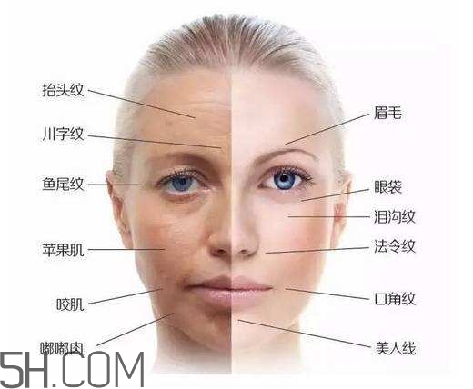 怎么預(yù)防皺紋的產(chǎn)生？導(dǎo)致皺紋的產(chǎn)生的原因有哪些？