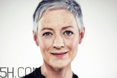 怎么預(yù)防皺紋的產(chǎn)生？導(dǎo)致皺紋的產(chǎn)生的原因有哪些？