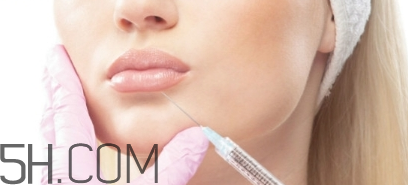 嬰兒肥能打瘦臉針嗎？瘦臉針打幾次可以定型？