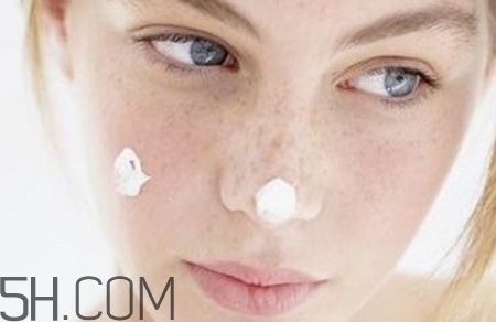 常見的色斑有哪些？常見的色斑有哪些種類？