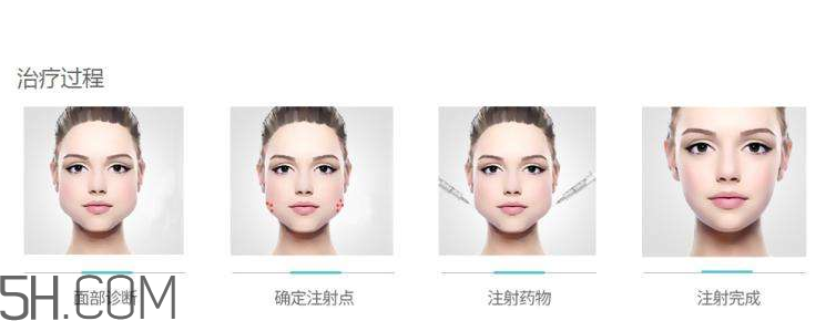 打瘦臉針可以抽煙嗎？打瘦臉針會反彈嗎？