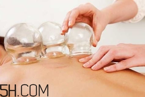 拔罐可以治療鼻炎嗎？鼻炎拔罐拔哪里？