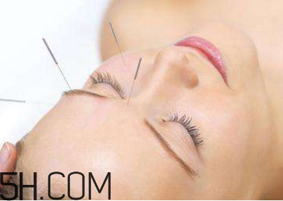 冬季最有效瘦臉方法 針灸可以瘦臉嗎 冬季最有效瘦臉方法 針灸可以瘦臉嗎