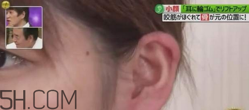 打瘦臉針的前后注意事項 臉胖的原因有哪些 打瘦臉針的前后注意事項 臉胖的原因有哪些