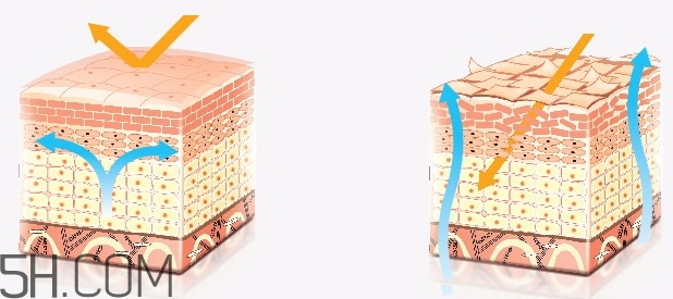 水楊酸可以去雞皮膚嗎？水楊酸治療雞皮膚方法