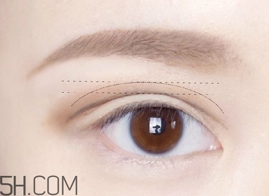 割完雙眼皮不能吃什么？割完雙眼皮如何進(jìn)行飲食調(diào)理？