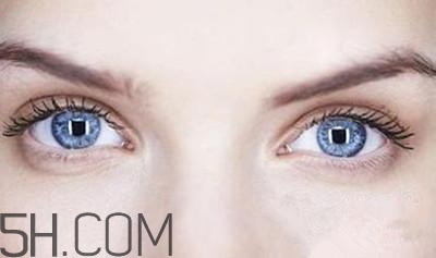 割完雙眼皮不能吃什么？割完雙眼皮如何進(jìn)行飲食調(diào)理？