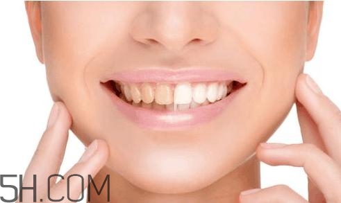 羨慕別人的大白牙？為什么你的牙齒這么黃？