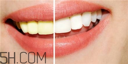 羨慕別人的大白牙？為什么你的牙齒這么黃？