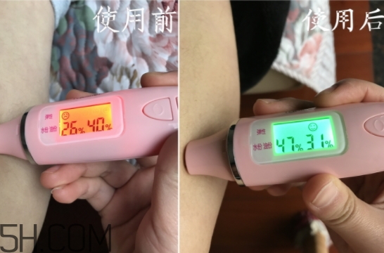 水楊酸可以去黑頭嗎？水楊酸可以去閉口嗎