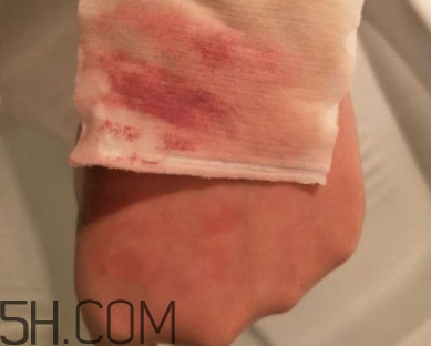 unny卸妝水和蓓昂斯哪個(gè)好？unny卸妝水和蓓昂斯對(duì)比