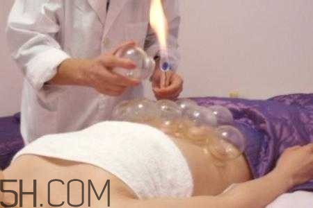 腹部拔罐可以減肥嗎？腹部拔罐拔哪個(gè)位置？